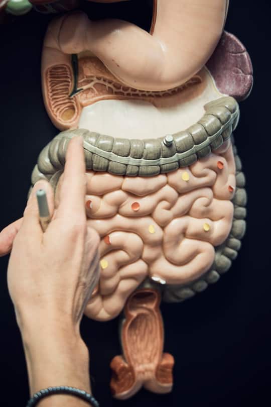 Darmspiegelung Hirslanden 2