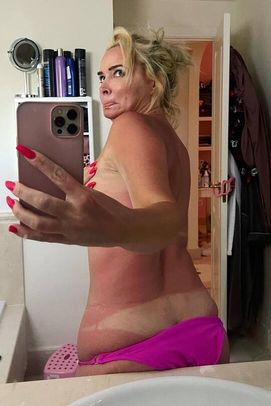 Daniela Katzenberger zeigt ihren fiesen Sonnenbrand