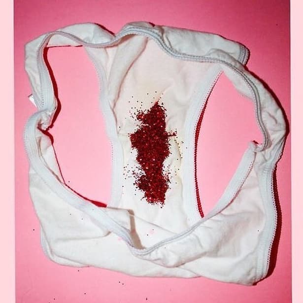 Ist brauner Ausfluss ein Grund zur Sorge?