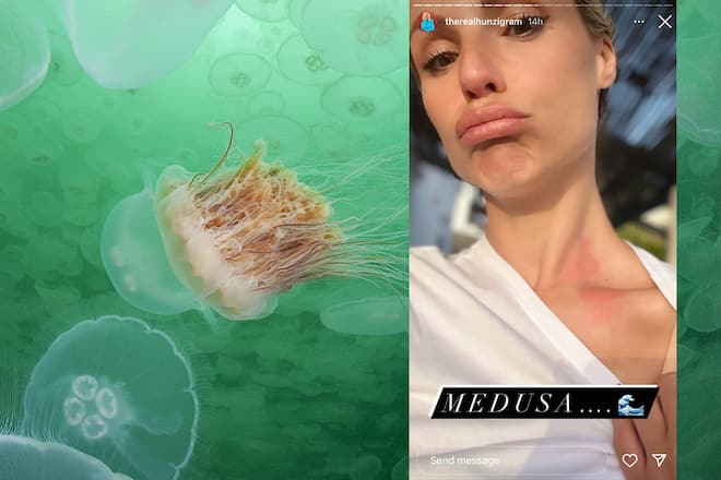 Qualle und Michelle Hunziker