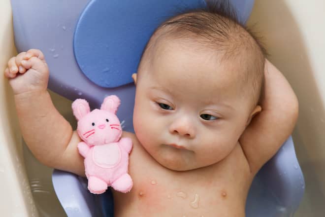 Baby mit Down-Syndrom