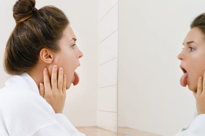 Nicht nur scharfes Essen sorgt für Brennen auf der Zunge.