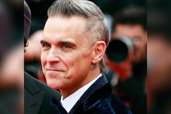 Robbie Williams hat keine Angst vor Schönheitseingriffen.