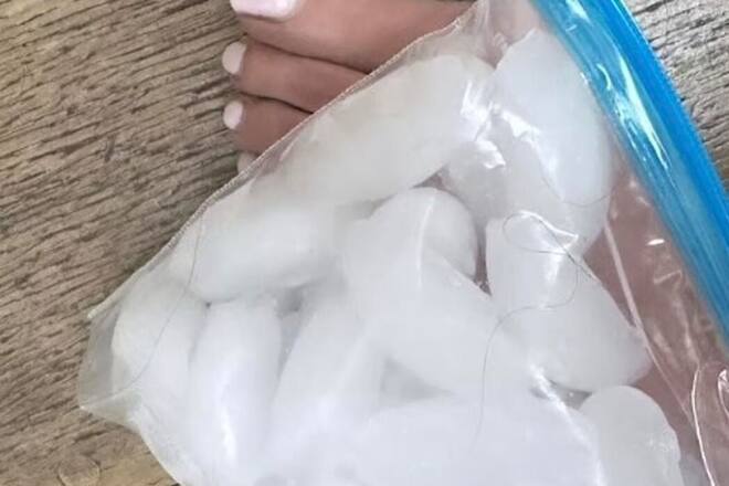 Das hat sicher weh getan: Victoria Beckham brach sich den Fuss im Gym.