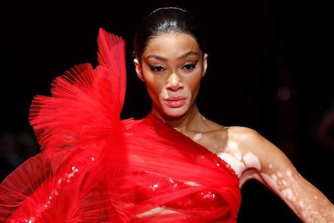 Im Netz verkündete Winnie Harlow die Verlobungs-News.