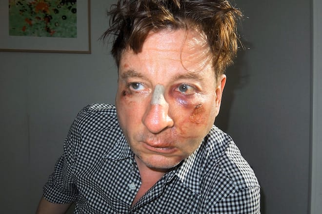 Beat Schlatter Schlägerei