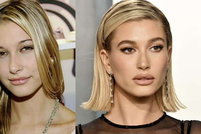 Hailey Bieber vor und nach ihren Schönheitsanpassungen